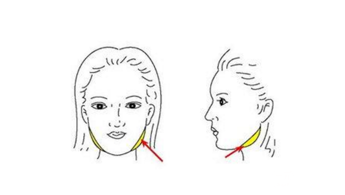 吸脂瘦脸手术术后一定要注意这些，别说我没告诉你！
