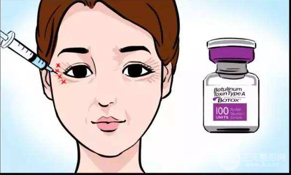 眼部注射去皱玻尿酸还是rd素?
