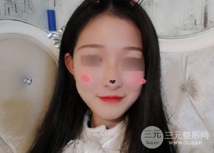 削骨瘦脸价格多少