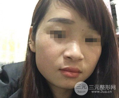 黑脸娃娃美容成好吗