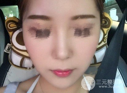 医院彩光美白嫩肤多少钱