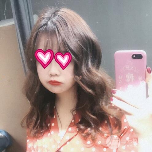 注射瘦脸瘦脸果图