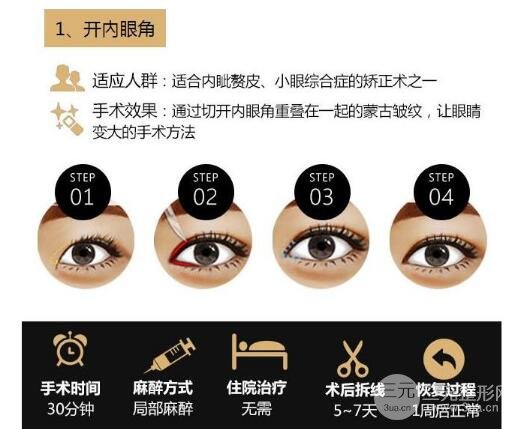 开眼角加双眼皮