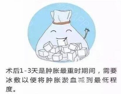 开眼角加双眼皮术后
