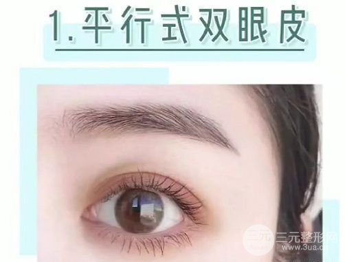 较好看的四种双眼皮