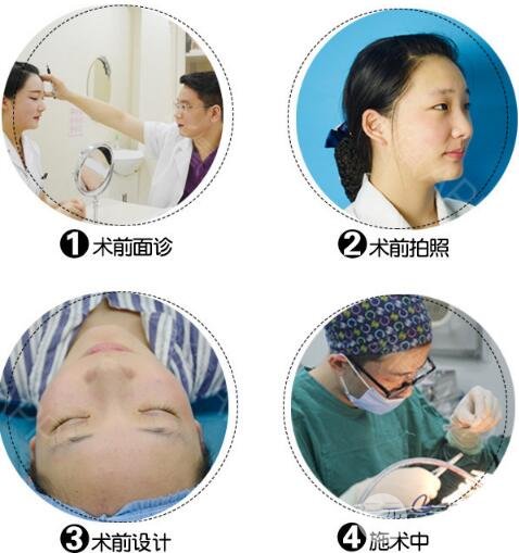 割双眼皮有哪些风险
