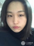 有打注射瘦脸5次以上的吗？本人来share一下真实体验感受