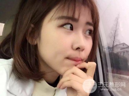 玻尿酸隆鼻对比图