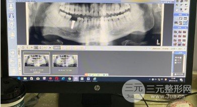 成都格林口腔价格表