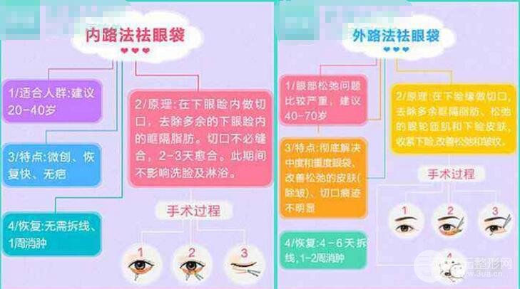 怎样才能基本去除眼袋
