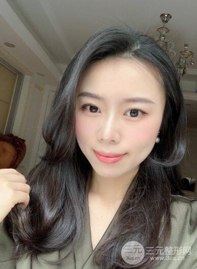 埋线手术半个月后