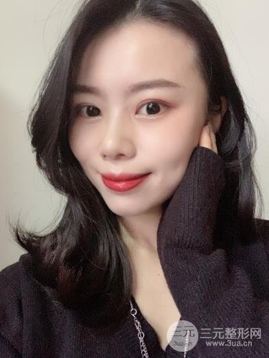 埋线手术三个月后