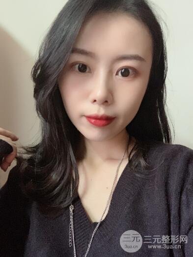 埋线手术三个月后