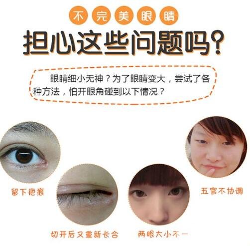 开眼角的风险