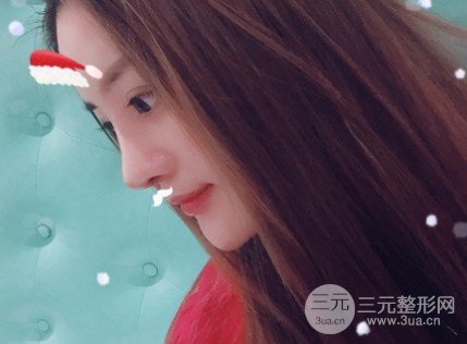 玻尿酸注射隆鼻的果
