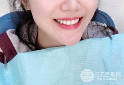 冷光美白牙齿的价格