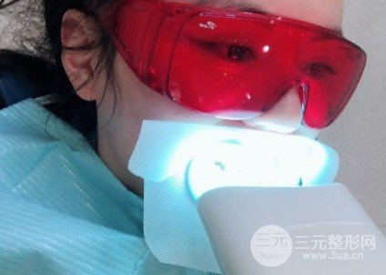 冷光美白牙齿的价格
