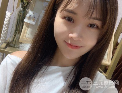 吴慧玲双眼皮修复经历