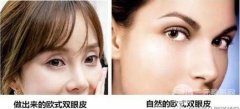 人欧式眼睛图片 想做超宽双眼皮先看看这些图