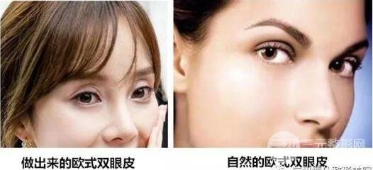 中国人欧式眼睛图片