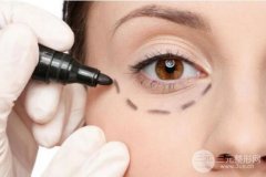 9个去眼袋的小妙招赶紧学起来，有摆脱眼袋困扰！