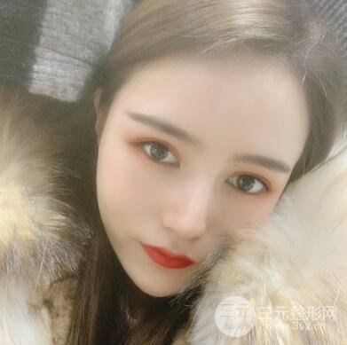 进行了纳米微创双眼皮