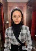 纳米双眼皮第7天恢复图分享，纳米双眼皮真人案例公开！