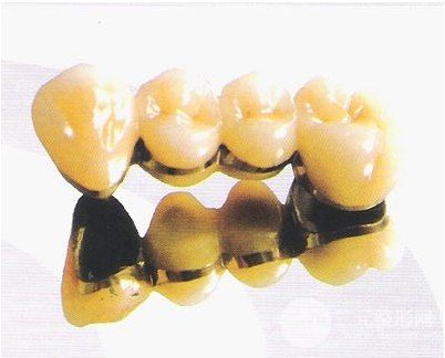 纳米烤瓷牙价格表