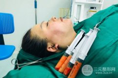 吸脂减肥手术价格多少?能[瘦]到什么程度?