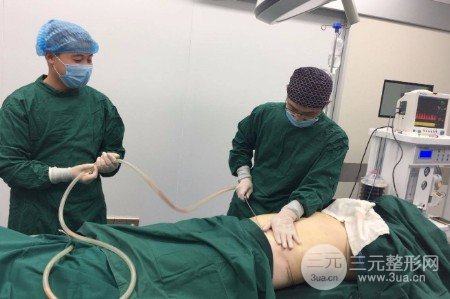 吸脂减肥手术价格