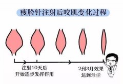 打注射瘦脸的副作用有哪些？来看这篇科普再决定打不打！