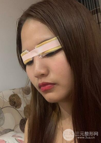 手术过程