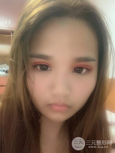 手术过程