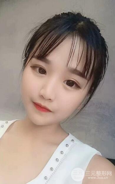 手术后一年的照片