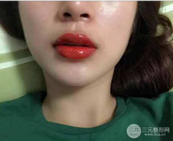 纹唇一到七天恢复图片果超水润的饱满又性感我超喜欢