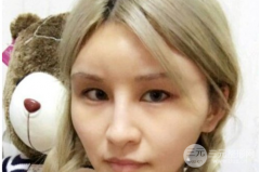 芭比眼睛双眼皮图片真人果参考，眼睛变大的果好明X！