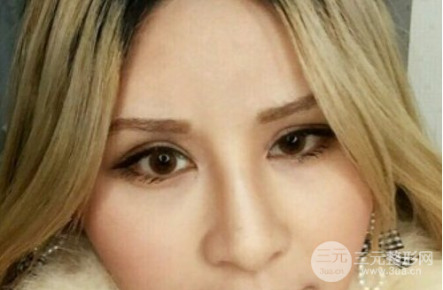 芭比眼睛双眼皮图片