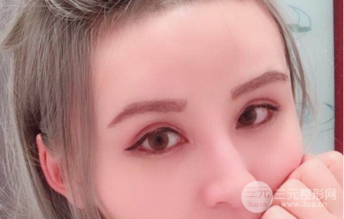 芭比眼睛双眼皮图片