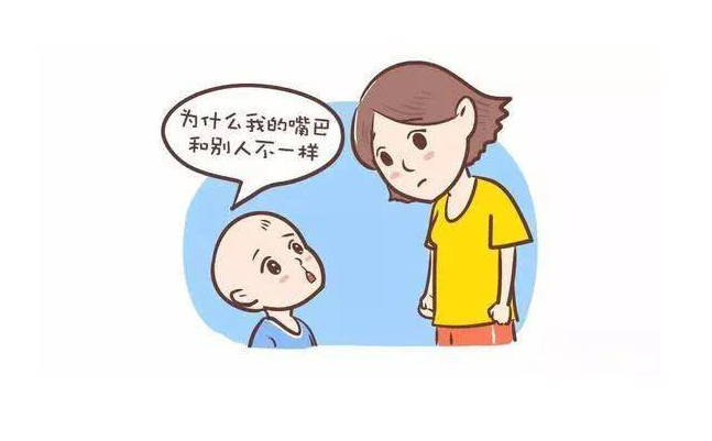 较严重的唇腭裂图片