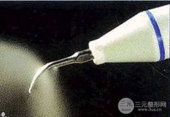 超声波洁牙多少钱？来看看值不值得花钱！