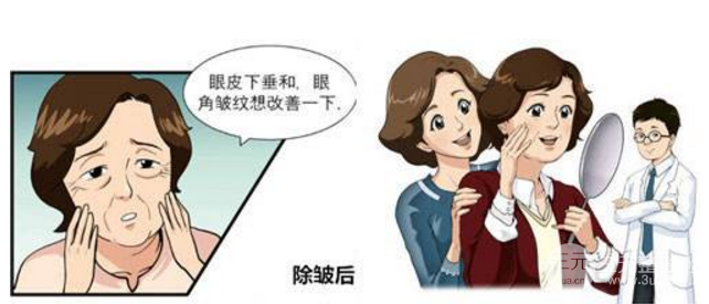 注射除皱降低风险吗