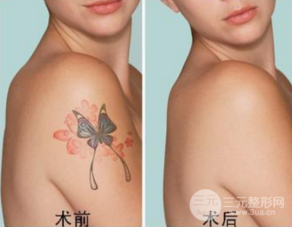 洗完纹身后的图片