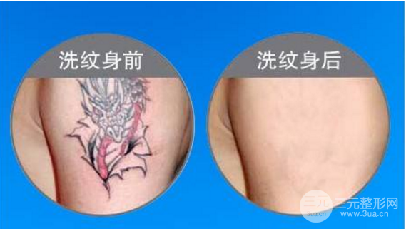 洗完纹身后的图片
