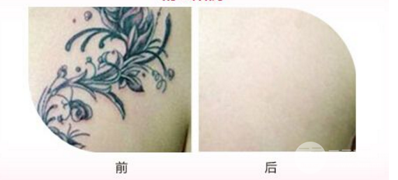 洗完纹身后的图片