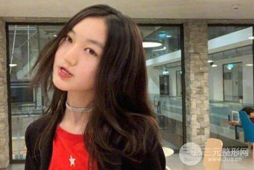 唇裂疤痕修复前后果图