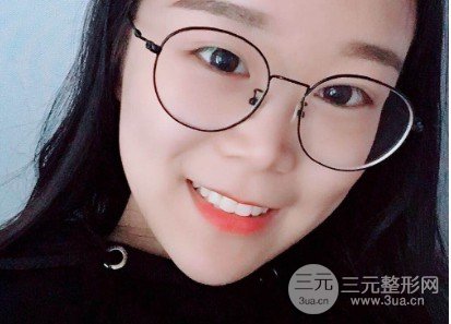 微创去眼袋**吗