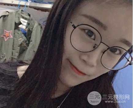 微创去眼袋**吗