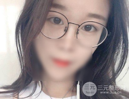 微创去眼袋**吗