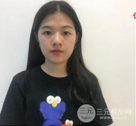微创双眼皮十天恢复图详细果披露，真人术后果照片