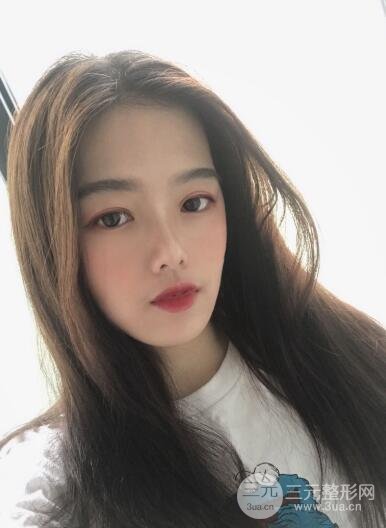 微创双眼皮